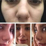 Iranian Big Nose