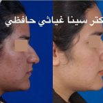 Persian Hooked Nose
