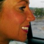 Rhinoplasty after pictures Boston plastic surgeons photos