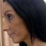 Rhinoplasty post op pictures New York City surgeons pictures