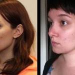 Rhinoplasty before after Charlotte nc cosmetic surgeons pictures