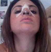 Rhinoplasty with septoplasty recovery after