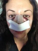 Plastic Surgery Tip Of Nose In Sydney Is One Of The Most Common Of All Plastic And Cosmetic Surgery Procedures