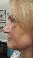 Beverly Hills, CA Perfect Nose Woman By Facial Plastic Surgeon DR. BEHROOZ TORKIAN