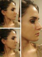 Dr Howard Webster Melbourne Nose Surgery Must Create A Nose That Is In Balance With The Rest Of The Face