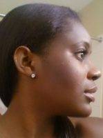 Different Types Of Nose Jobs For African American Woodbridge NJ Pic