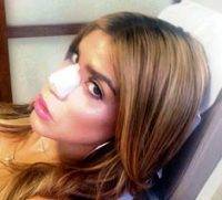 nose lebanon perfect rhinoplasty cost woman job