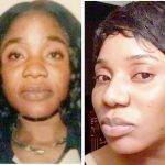 The Perfect African American Nose Job Pictures