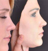 3D Plastic Cosmetic Surgery Simulator