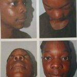 African American Plastic Surgery Before And After Images