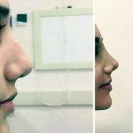 Aquiline Noses On Women