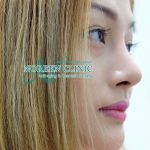 Asian Rhinoplasty Is A Highly Specialized Form Of Cosmetic Rhinoplasty Performed In This Particular Patient Population
