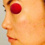 Asian Women Usually Want To Make Their Faces Shapelier While Correcting Any Imbalances In Their Facial Structure