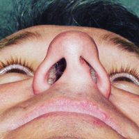 The Asymmetric Male Nose