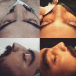 Great Male Nose Jobs (1)