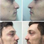 Hooked Nose Images (4)