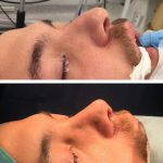 Male Hooked Nose Pictures