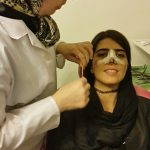 Persian Nose Surgery Photos (6)