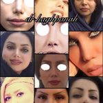 Persian Plastic Surgery For Nose (2)