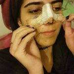 Photos Of Persian Nose Job Before And After (4)