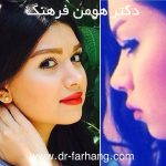 Plastic Surgery For Persian Nose (2)