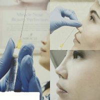 Radiesse Nose Job Is A Revolutionary Non-invasive Cosmetic Procedure