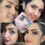 The Persian Nose Pictures (2)