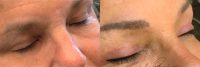 45-54 year old woman treated with Permanent Makeup