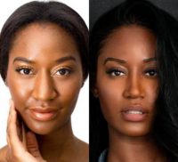 35-44 year old woman treated with African American Rhinoplasty