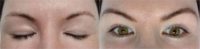 34 year old woman treated with Microblading